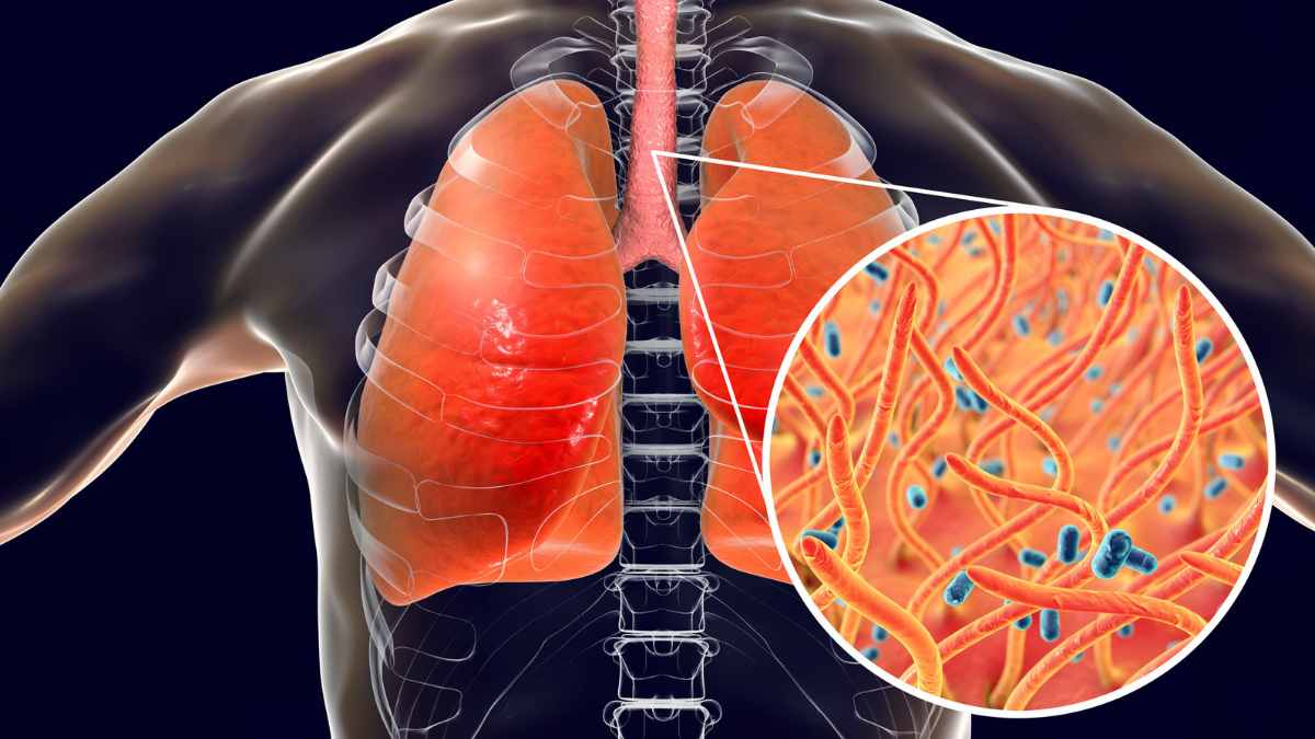 Contaminación | Tu Colonia Nuevo León